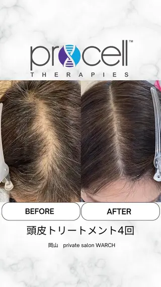 WARCH Marieのその他イメージ