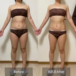 未病ケアサロン EMINY所属・未病ケアサロン EMINY☺︎勝俣のエステ・リラクイメージ