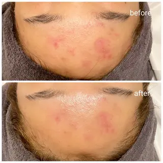 今西 彩夢のエステ・リラクイメージ