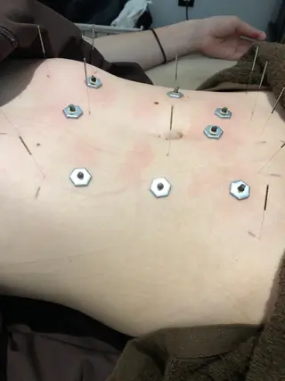 美容鍼灸整体サロンBeauJu所属・小顔矯/美容鍼/鍼灸 BeauJuのその他イメージ