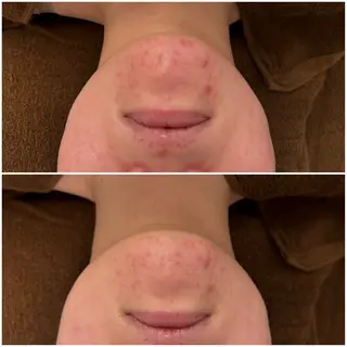 23beauty所属・武藤 那月のエステ・リラクイメージ