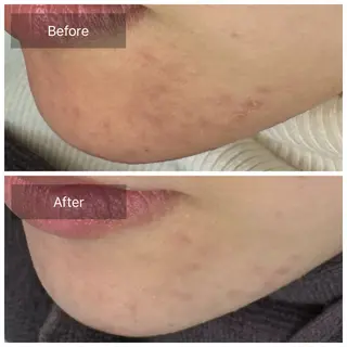 トータルしみケア専門 NICA(ニカ)のエステ・リラクイメージ