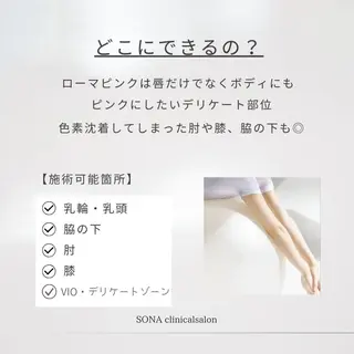 小顔/たるみ/黒ずみ除去専門サロン/SONA 大和西大寺店所属・【小顔専門看護師 サロンSONA】のエステ・リラクイメージ