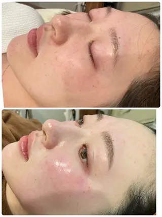 アイブロウ MAEDA .のエステ・リラクイメージ