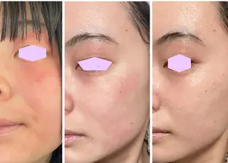 bibiche Rのエステ・リラクイメージ