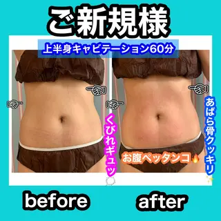 痩身/脱毛/ネイル HARUKAのエステ・リラクイメージ