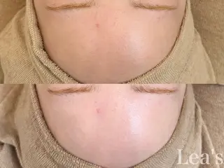 Lea's所属・【Lea's 】 hazukiのエステ・リラクイメージ