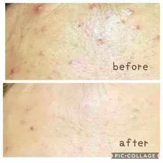 美肌蘇生カウンセラー 横山りえのエステ・リラクイメージ