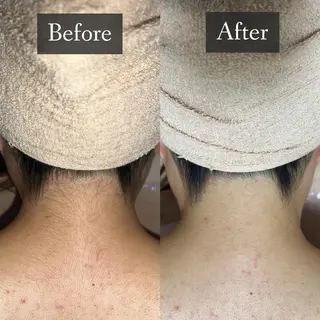 脱毛専門サロン BELFINE恵比寿のエステ・リラクイメージ