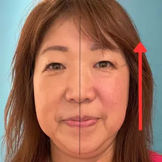 Nexfit for Beauty小顔矯正のエステ・リラクイメージ