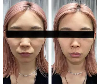 ENCHANT 脱毛.小顔.毛穴のエステ・リラクイメージ