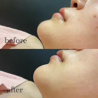 🫧美しい素肌へ🫧 今成柚乃のその他イメージ