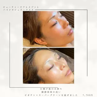 代表 MOMOのエステ・リラクイメージ