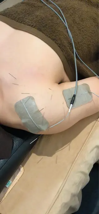 美容鍼灸整体サロンBeauJu所属・小顔矯/美容鍼/鍼灸 BeauJuのその他イメージ