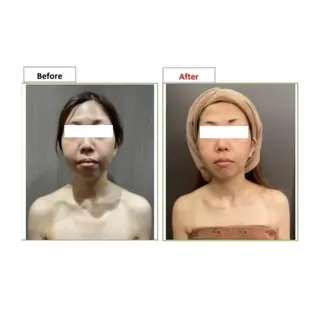 レイビス 渋谷店❤️のエステ・リラクイメージ