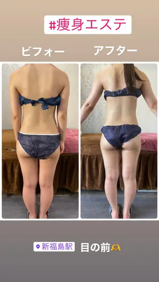 FLEUR 2号店のエステ・リラクイメージ