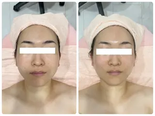 本格派エステ ハピスリーのエステ・リラクイメージ