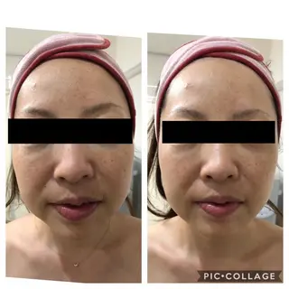 BeautySalonGemmy所属・Gemmy 愛美のエステ・リラクイメージ