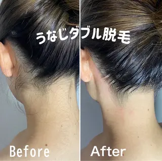 ブラジリアンワックス&美肌脱毛　エピナス大和店所属・エピナス 大和店のエステ・リラクイメージ