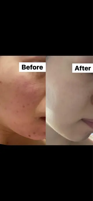 Remina clinical salon所属・ハイフ美肌専門 Remina.c.sのエステ・リラクイメージ