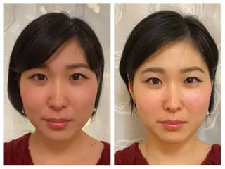 小顔矯正サロンLily所属・小顔矯正サロン Lilyのエステ・リラクイメージ