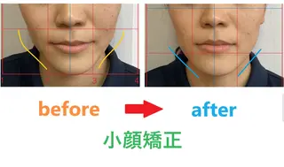 豊津BM整骨院所属・木田 明訓のエステ・リラクイメージ