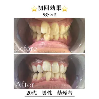 セルフホワイトニング White33大名のその他イメージ