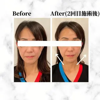 12Dハイフ💗 最強小顔のエステ・リラクイメージ