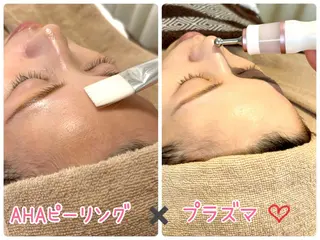 salon A.glansh所属・肌質改善salon♪ 効果がわかる♪南森町のネイルデザイン