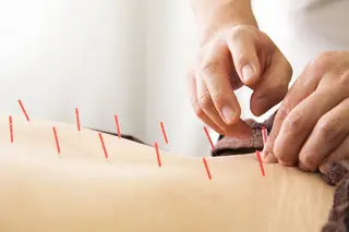 特別クーポン配布中 美容鍼・整体お得に！のその他イメージ