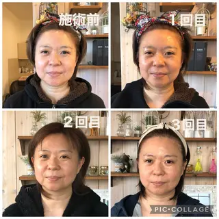 小顔専門 ヘッドスパ【jiu】のエステ・リラクイメージ