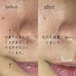 脱毛サロン KiWiのエステ・リラクイメージ