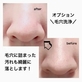 M. lisyelのエステ・リラクイメージ