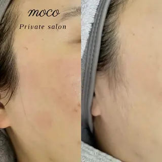 private salon moco所属・まつ毛&ワックス脱毛 tomoの眉毛・アイブロウイメージ