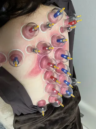 やはた鍼灸整骨院所属・やはた 鍼灸整骨院のエステ・リラクイメージ