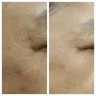 loa まつ毛と肌管理のお店のマツエク・マツパデザイン