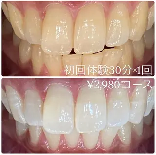 メンズ ホワイトニングルーム　川崎店所属・ホワイトニング ルーム　川崎店のその他イメージ