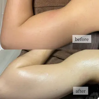 HINANO矢場町店【ヒナノ】所属・脱毛/肌改善🌿 HINANO 村田のエステ・リラクイメージ