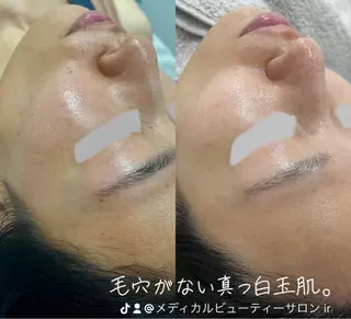 メディカルエステサロンir アイアール所属・韓国肌管理　肌質改善 irのエステ・リラクイメージ