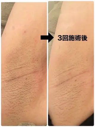 LONO  by a little所属・LONO byalittleのエステ・リラクイメージ