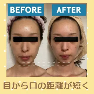 小顔矯正サロン プルメリアのエステ・リラクイメージ