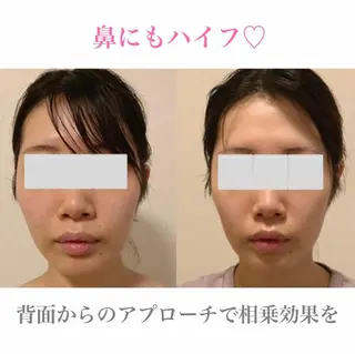 a room salonのエステ・リラクイメージ