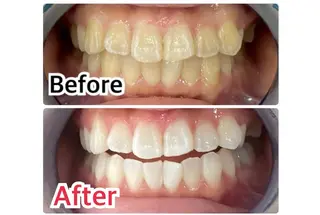 プラチナムビューティー柏所属・【歯科提携】柏ホワイ トニングスタイルのその他イメージ