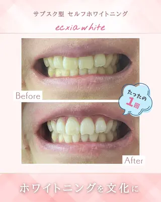 セルフホワイトニングサロン　エクシアホワイト西尾店所属・エクシアホワイト西尾 堀内恵のその他イメージ