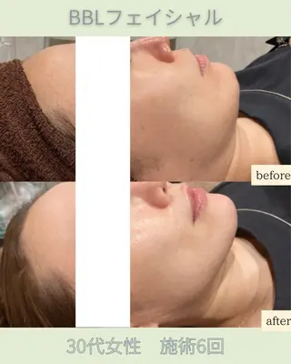 DahliaBeauty ダリアビューティー所属・DahliaBeau tyフェイシャル中村のエステ・リラクイメージ