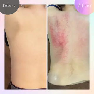 鍼灸院楽々館所属・宇田 碧のエステ・リラクイメージ