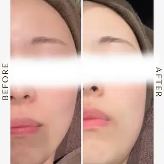 毛穴専門店Bébé 大阪中央店のエステ・リラクイメージ