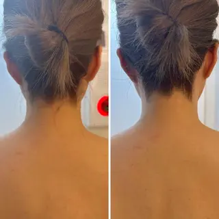 うなじ脱毛/美肌脱毛 LABELのエステ・リラクイメージ