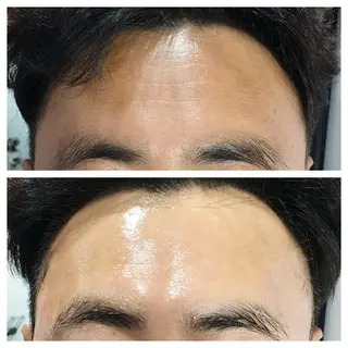 表参道鍼灸院K 美容鍼🔮ララピールのエステ・リラクイメージ