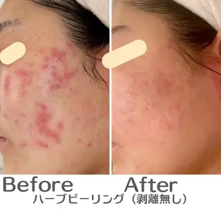 最速小顔・肌質管理 espoirマキのエステ・リラクイメージ